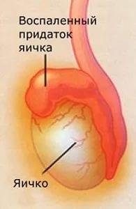 Hogyan működik egy ember mashonki (mashonki) Hogyan működik egy ember mashonki