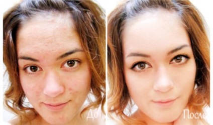 Ricinusolaj az arc tisztítása, vélemények fotókkal előtt és után