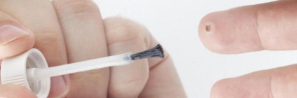 Ricinusolaj a papillomák alkalmazás válaszok (papillomák) Ricinusolaj alkalmazásából származó papilloma, vélemények