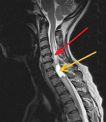 A ciszta, hogy és milyen faj található a gyakorlatban (tumor) A ciszta, hogy és milyen faj található a gyakorlatban