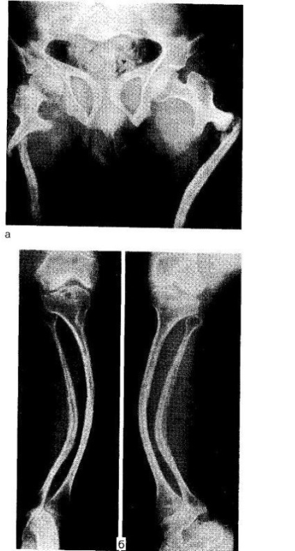 A klinikai (protézis) besorolás (osteomyelitis) A klinikai (protézis) besorolás