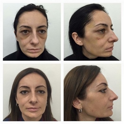 Clinic és professzor Orlov (fogfehérítés) Klinika professzora Orlov