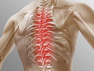 Colitis a mellkas jobb, bal, közép (mellkasi) Colitis a mellkas jobb, a bal, a középső