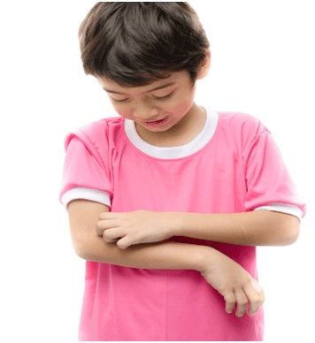 Szúnyogcsípés gyermekeknél - 7 módon, hogy enyhíti a viszketést és az allergia