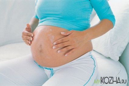 Krém terhességi csíkok terhes áttekintést a leghatékonyabb