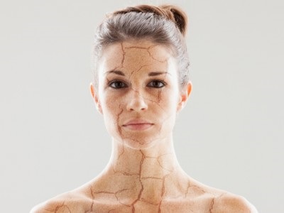 Rosacea krém véleménye az arcon (krém) Cream rosacea az arc vélemények