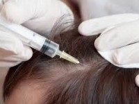 A kezelés a fejbőr és a haj különböző kezelések