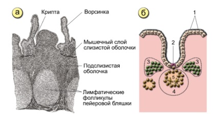 A limfoid hiperplázia antrális gyomornyálkahártya (gyomor) A limfoid hiperplázia antrális gyomornyálkahártya