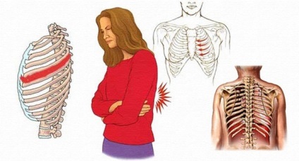 bordaközi izomgyulladás tünetei