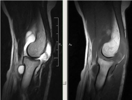 MRI a könyökízület, amely megmutatja, képzés, felolvasások