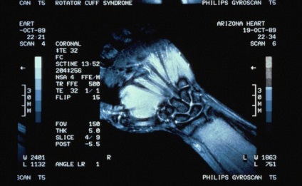 MRI a csukló és a kéz, amely azt mutatja, a készítmény, jelzések