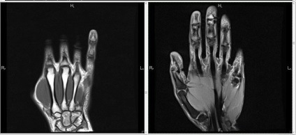 MRI csukló ízületi károsodás ár, fénykép, vélemény