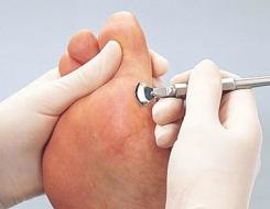 Láb jó kezekben rangsor a legjobb krémek (a legjobb) Láb jó kezekben rangsor a legjobb krém a lábaknak
