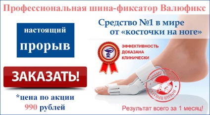 Duzzadt láb csont, hogy mit kell csinálni, és hogyan kell kezelni (duzzadt) Duzzadt láb csont, hogy mit kell csinálni, és hogyan kell kezelni