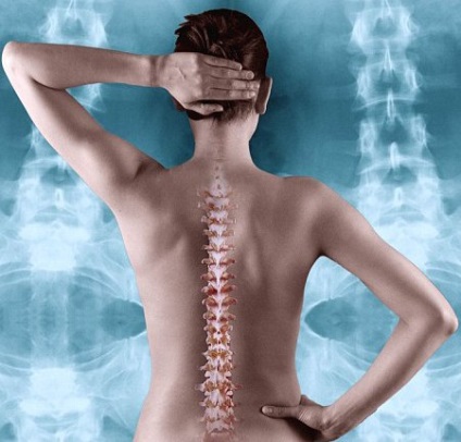 Osteochondrosis hogyan fájdalom szabadság perc (biológiailag aktív pontok) Osteochondrosis hogyan lehet a fájdalom elmegy tee