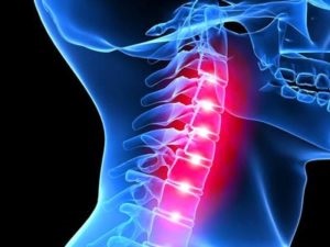 Osteochondrosis a nyaki gerinc okozza előfordulási (gerinc) Osteochondrosis a nyaki gerinc okozza az esemény