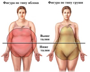 Elhízás - okai, tünetei és népi jogorvoslati elhízás kezelésében
