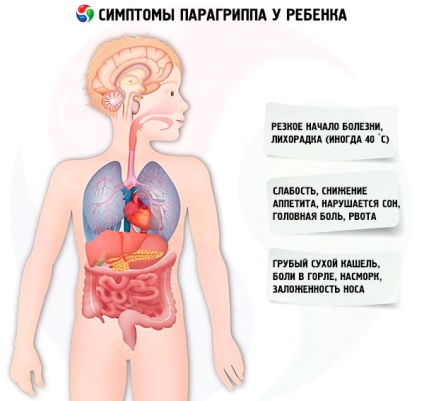 Parainfluenza gyermekeknél okoz, tünetei, diagnózisa, kezelése, az illetékes egészségügyi on iLive