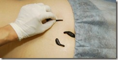 Leech nem akar ragaszkodni, samaramed (pióca) Leech nem akar ragaszkodni, samaramed