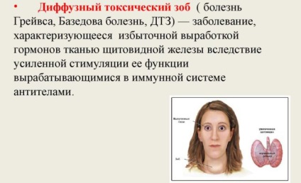 Posztoperatív pajzsmirigyműködés kezelésében pajzsmirigy (pajzsmirigy) Posztoperatív hypothyreosis pajzsmirigy kezelésére