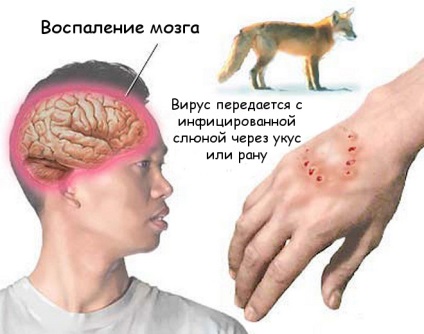 Jelek a veszettség emberre, miután megmarta egy macska (férfi) Jelek a veszettség emberre után egy macska harapás