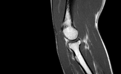 Lebonyolítása MRI a könyök
