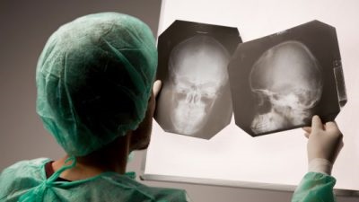 orr röntgen milyen gyakran lehet csinálni, dekódolás röntgen az orrmelléküregek (X-ray) orr röntgen milyen gyakran lehet csinálni, dekódolás röntgen orrmelléküregek