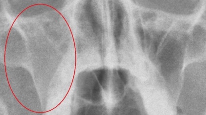 X-sugarak a orrmelléküregek hol és milyen gyakran lehet csinálni, megfejteni