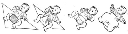 Széles diapering dysplasia (képekben), aktív anyukája (széles) Széles diapering dysplasia (képekben), az aktív anya