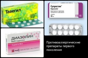 Tabletta allergia - működési elv, a generációs gyógyszerek (elv) Allergia elleni tabletták - működési elv, a generációs gyógyszerek