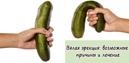 Lassú erekció lehetséges okok és a kezelés (erekció) Petyhüdt erekció lehetséges okai és kezelése