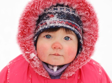 Allergia a gyermeket a hideg tippek