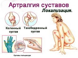 Ízületi fájdalom - okok, tünetek, tünetei és kezelése
