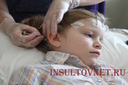 Nem görcsös epilepszia, gyermekkori absence rohamok és más típusú rohamok
