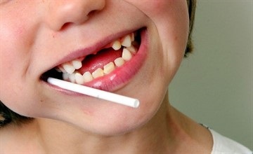 Vannak baba foga fáj a gyerekek miért fáj egy ideiglenes fogat a gyermek és mit kell csinálni