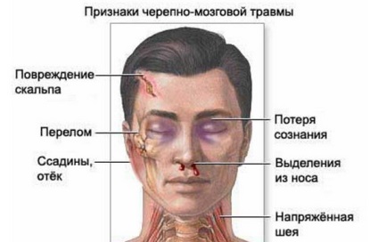Traumás agysérülés - tünetek, okok, kezelés és diagnózis