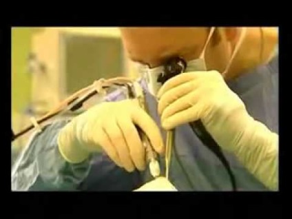 Az orrmelléküreg-gyulladás sinusitis és mi a különbség, az orvostudomány és a népi jogorvoslati kezelésére