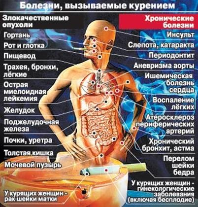 szívkoszorúér-betegség hatása az egészségre)