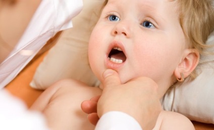 Ami miatt fennáll a krónikus stomatitis a gyermek, és hogyan kell gyógyítani