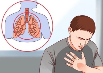 Hogyan hal meg tüdőrákban és halálokok betegek