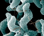 Campylobacteriosis - okai, tünetei, diagnózisa és kezelése