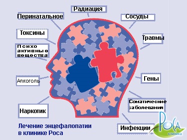 neuralgia kezelésére