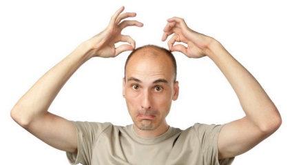 Kenőcs alopecia felülvizsgálatát krémek és balzsamok alopecia