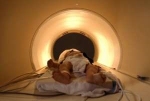 MRI az agy az újszülöttek