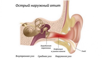 Німіє вухо причини, симптоми і лікування