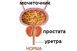 prosztata kezelési módszerek)