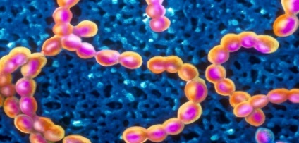 Hány nap fertőző mandulagyulladás milyen hosszú egy személy ragályos az angina (angina) Hány nap fertőző mandulagyulladás milyen hosszú egy személy fertőző torokfájás