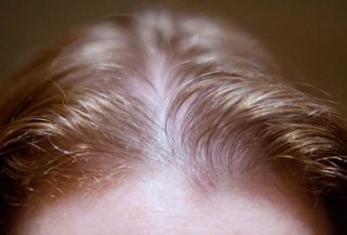 Hogy szükséges-e nőni vékony szőr