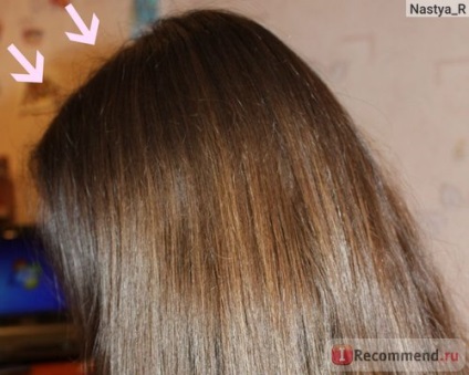 Tojás - „hogyan lehet növelni a sűrűsége haj! Kaptam 2 hónap és 17% (az új fotó -