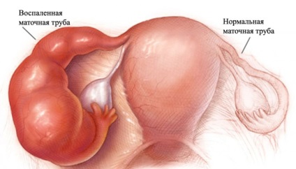 Az illata a kellemetlen vaginális, hal, állott, rossz, szúrós szaga a halak, a vas, szikra szag (éles) Az illata a kellemetlen vaginális, hal, állott, rossz, szúrós szaga a halak, a vas, szikra szag